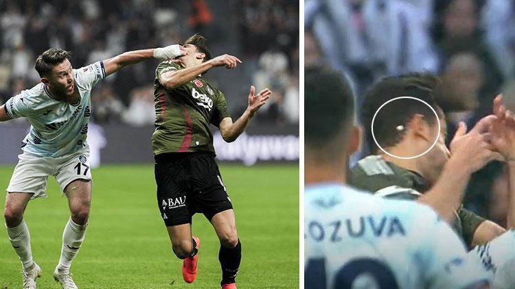Beşiktaş'ta Gabriel Paulista'nın Dişi Kırıldı: Sakatlıklar Takımı Zor Duruma Soktu