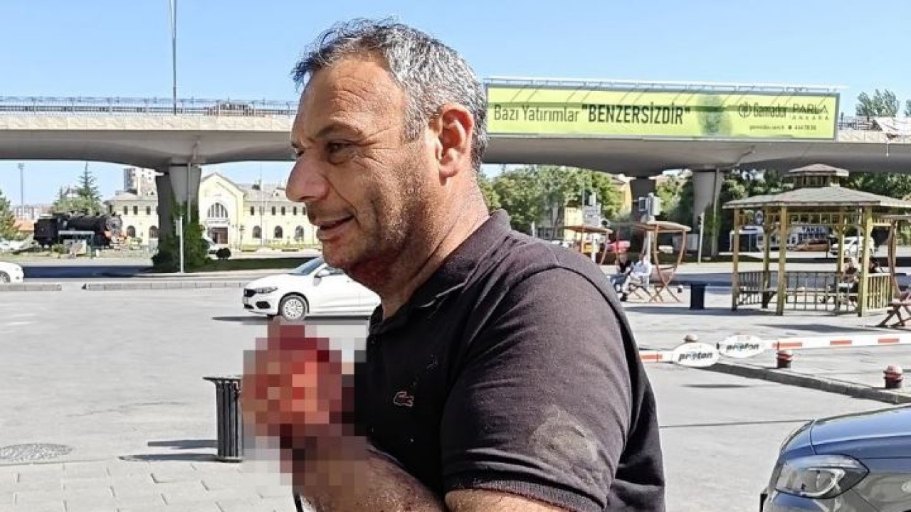 Kayseri'de Kurban Kesimi Sırasında Yaralanan Acemi Kasaplar Acil Servislere Başvurdu