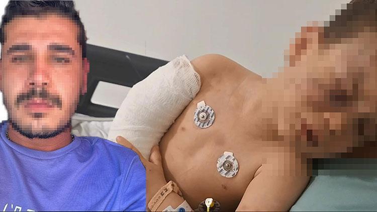 Denizli'de 2 Yaşındaki Çocuk Şiddete Maruz Kaldı: Yoğun Bakımda Tedavi Görüyor