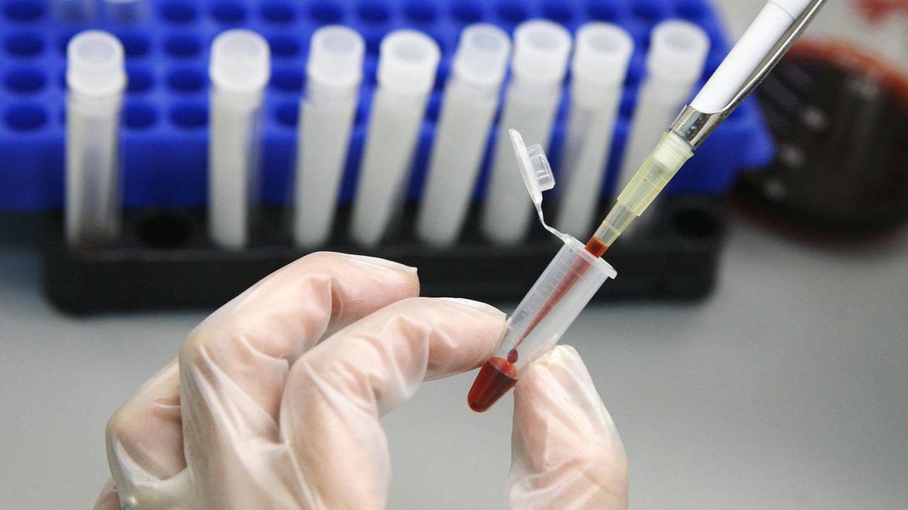 HIV Tedavisinde Tarihi Adım: Virüs Hücre İçinde Görünür Hale Getirildi